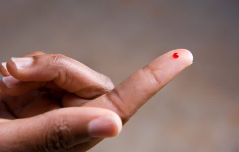 A drop of blod on a young African American woman's fingertip.  She is preparing to perform a blood sugar test.