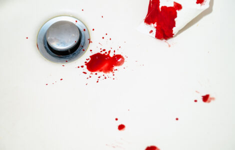 Red blood drops in white bathroom sink. Real blood as traces and evidence of a crime. Concept of nosebleed, injury, violence, murder or suicide. Blood stains on ceramic background. Closeup.